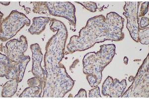Immunohistochemistry (Paraffin-embedded Sections) (IHC (p)) image for anti-Annexin A5 (ANXA5) antibody (ABIN7234522)