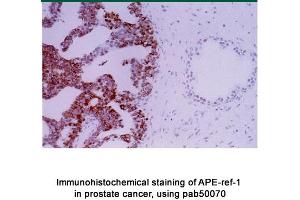 Image no. 2 for anti-Apurinic/Apyrimidinic Endonuclease 1 (APEX1) antibody (ABIN363379) (APEX1 antibody)