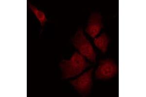 ABIN6274503 staining Hela by IF/ICC. (ILKAP antibody  (N-Term))