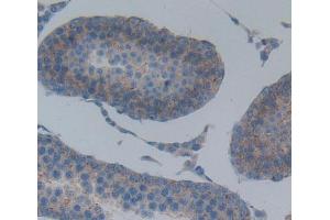 Used in DAB staining on fromalin fixed paraffin- embedded testis tissue (ABCB8 antibody  (AA 468-714))