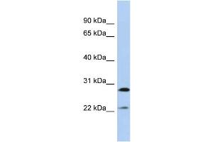Host:  Rabbit  Target Name:  FGB  Sample Type:  MCF7 Whole Cell lysates  Antibody Dilution:  1. (Fibrinogen beta Chain antibody  (Middle Region))