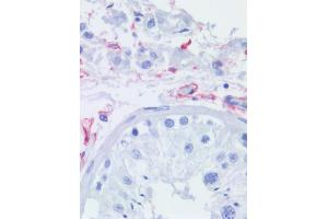 Immunohistochemistry staining of human testis (paraffin sections) using anti-CD271 (NGFR5). (NGFR antibody)