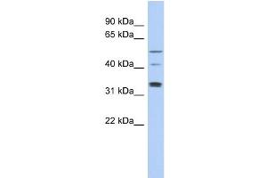 WB Suggested Anti-TCP11 Antibody Titration: 0. (TCP11 antibody  (Middle Region))