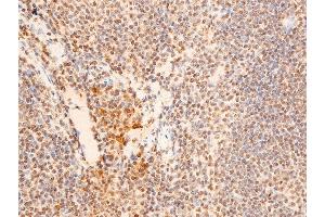 Immunohistochemistry (IHC) image for anti-Checkpoint Kinase 2 (CHEK2) (pThr383) antibody (ABIN6256552)