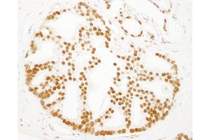 Immunohistochemistry (IHC) image for anti-SET Nuclear Oncogene (SET) (AA 125-175) antibody (ABIN7448788)