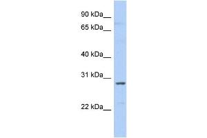 WB Suggested Anti-SNRPA1 Antibody Titration:  0.