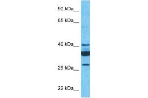 Host:  Rabbit  Target Name:  SLC35C1  Sample Type:  721_B Whole Cell lysates  Antibody Dilution:  1. (SLC35C1 antibody  (C-Term))