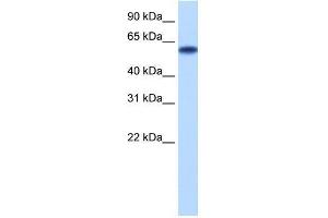 Transfected 293T; WB Suggested Anti-ZNF394 Antibody Titration: 0.
