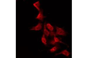 ABIN6267614 staining NIH-3T3 by IF/ICC. (PKC zeta antibody  (pThr560))