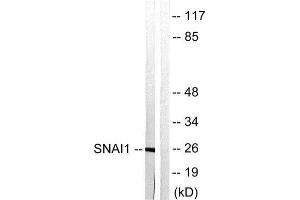 Western Blotting (WB) image for anti-SNAIL (SNAI1) (Ser246) antibody (ABIN1848080) (SNAIL antibody  (Ser246))