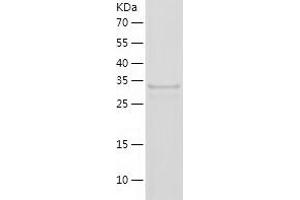 Western Blotting (WB) image for Neuromedin B (AA 25-121) protein (His-IF2DI Tag) (ABIN7283151) (Neuromedin B Protein (AA 25-121) (His-IF2DI Tag))