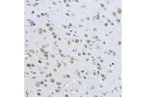 Immunohistochemistry (IHC) image for anti-RNA Binding Protein, Fox-1 Homolog 3 (RBFOX3) (AA 1-220) antibody (ABIN1513254)
