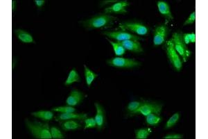 Immunofluorescence staining of Hela cells with ABIN7149997 at 1:100, counter-stained with DAPI. (MVD antibody  (AA 69-221))