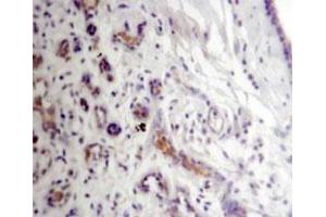 Immunohistochemistry of human breast with RARS polyclonal antibody . (RARS antibody)