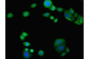Immunofluorescent analysis of PC-3 cells using ABIN7163117 at dilution of 1:100 and Alexa Fluor 488-congugated AffiniPure Goat Anti-Rabbit IgG(H+L) (TAM41 antibody  (AA 161-452))