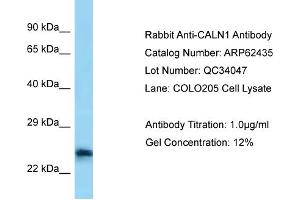 Western Blotting (WB) image for anti-Calneuron 1 (CALN1) (C-Term) antibody (ABIN2789143)