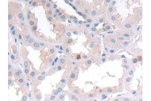 Detection of NCAD in Human Kidney Tissue using Polyclonal Antibody to N-cadherin (NCAD) (N-Cadherin antibody  (AA 685-784))