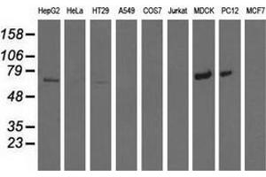 Western blot analysis of extracts (35 µg) from 9 different cell lines by using anti-MTMR14 monoclonal antibody. (MTMR14 antibody)