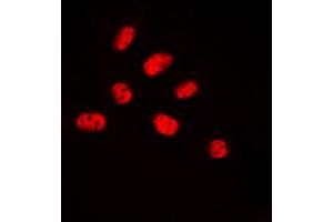 Immunofluorescent analysis of NET (pS357) staining in HUVEC cells. (ELK3 antibody  (C-Term, pSer357))