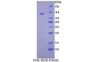 SDS-PAGE (SDS) image for Syndecan 1 (SDC1) (AA 58-313) protein (His tag,GST tag) (ABIN2123637) (Syndecan 1 Protein (SDC1) (AA 58-313) (His tag,GST tag))
