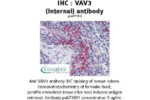Image no. 2 for anti-Vav 3 Oncogene (VAV3) (Internal Region) antibody (ABIN1740680) (VAV3 antibody  (Internal Region))