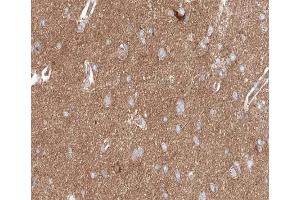ABIN6267617 at 1/200 staining human brain tissue sections by IHC-P. (PKC delta antibody  (pSer645))