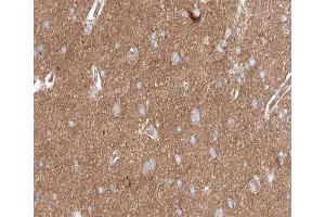 ABIN6267617 at 1/200 staining human brain tissue sections by IHC-P.