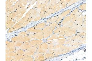 ABIN6255205 and ABIN6267091 at 1/100 staining Rat skin tissue by IHC-P. (TBC1D4 antibody  (pSer318))