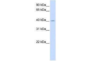 ACAA2 antibody used at 1 ug/ml to detect target protein. (ACAA2 antibody  (N-Term))