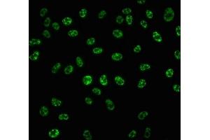 Immunofluorescence staining of Hela cells with ABIN7127746 at 1:100,counter-stained with DAPI. (Recombinant RPS6KB1 antibody  (pSer424, pThr421))