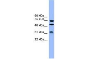 Image no. 1 for anti-serpin Peptidase Inhibitor, Clade A (Alpha-1 Antiproteinase, Antitrypsin), Member 4 (SERPINA4) (AA 271-320) antibody (ABIN6745377) (SERPINA4 antibody  (AA 271-320))