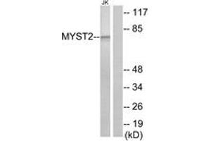 Western blot analysis of extracts from Jurkat cells, using MYST2 Antibody.