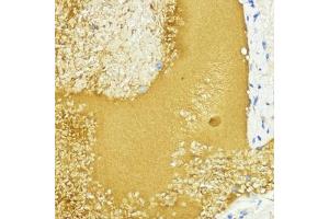 Immunohistochemistry of paraffin-embedded mouse liver using IGF1 antibody (ABIN6134370, ABIN6142231, ABIN6142233 and ABIN6215544) at dilution of 1:100 (40x lens). (IGF1 antibody  (AA 50-150))