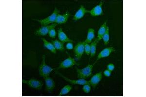 IF analysis of AS160/TBC1D4 using anti-AS160/TBC1D4 antibody (ABIN7599745). (TBC1D4 antibody  (AA 1118-1298))