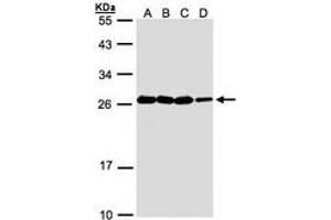 Image no. 1 for anti-Hematological and Neurological Expressed 1 (HN1) (AA 1-176) antibody (ABIN467491) (HN1 antibody  (AA 1-176))