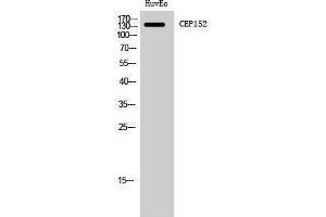 Western Blotting (WB) image for anti-Centrosomal Protein 152kDa (CEP152) (Internal Region) antibody (ABIN3183858)