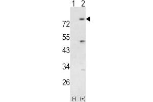 Western Blotting (WB) image for anti-Phosphoinositide-3-Kinase, Regulatory Subunit 5 (PIK3R5) antibody (ABIN3003638) (PIK3R5 antibody)