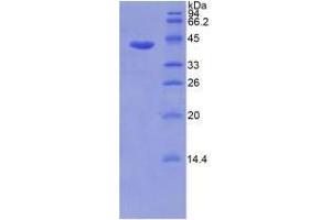 SDS-PAGE analysis of Human Matrix Metalloproteinase 8 (MMP8) Protein. (MMP8 Protein)