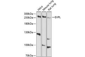 Western blot analysis of extracts of various cell lines, using EVPL antibody (ABIN6129811, ABIN6140350, ABIN6140351 and ABIN6214378) at 1:1000 dilution. (Envoplakin antibody  (AA 1784-2033))