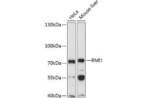 Western blot analysis of extracts of various cell lines, using RMI1 Antibody (ABIN1682540, ABIN3019316, ABIN3019317, ABIN5664937 and ABIN6220821) at 1:1000 dilution. (RMI1 antibody  (AA 1-350))