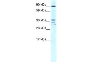 Western Blotting (WB) image for anti-Zinc Finger CCCH-Type Containing 7B (ZC3H7B) antibody (ABIN2460487) (ZC3H7B antibody)