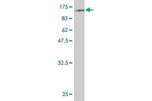 Western Blot detection against Immunogen (88. (ZYX antibody  (AA 1-572))