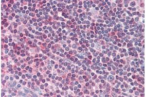 Human Tonsil (formalin-fixed, paraffin-embedded) stained with CENTB1 antibody ABIN337010 at 5 ug/ml followed by biotinylated anti-goat IgG secondary antibody ABIN481715, alkaline phosphatase-streptavidin and chromogen. (ACAP1 antibody  (AA 728-740))