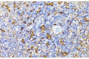 Immunohistochemistry of paraffin-embedded Rat spleen using VEGF Receptor 1 Polyclonal Antibody at dilution of 1:100 (40x lens). (FLT1 antibody)