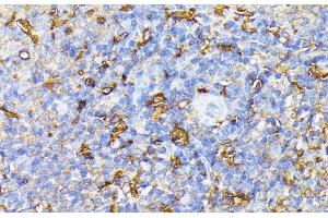 Immunohistochemistry of paraffin-embedded Rat spleen using VEGF Receptor 1 Polyclonal Antibody at dilution of 1:100 (40x lens). (FLT1 antibody)