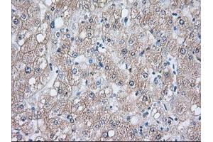 Immunohistochemistry (IHC) image for anti-Heat Shock 70kDa Protein 1A (HSPA1A) antibody (ABIN1498743) (HSP70 1A antibody)
