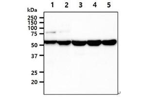 The cell lysates (40ug) were resolved by SDS-PAGE, transferred to PVDF membrane and probed with anti-human UGDH antibody (1:1000). (UGDH antibody)
