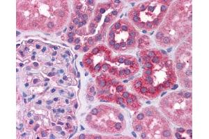 Immunohistochemistry (IHC) image for anti-Signal Transducer and Activator of Transcription 6, Interleukin-4 Induced (STAT6) (C-Term) antibody (ABIN2777200) (STAT6 antibody  (C-Term))