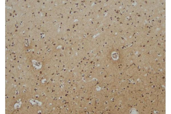 EPN3 antibody  (Internal Region)