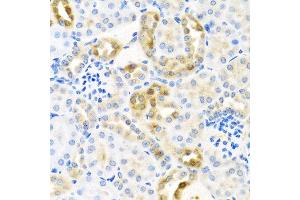Immunohistochemistry of paraffin-embedded mouse kidney using CST4 antibody at dilution of 1:100 (40x lens). (CST4 antibody)